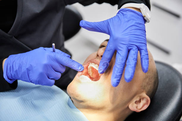 Best Emergency Wisdom Teeth Removal in Jamaica Beach, TX